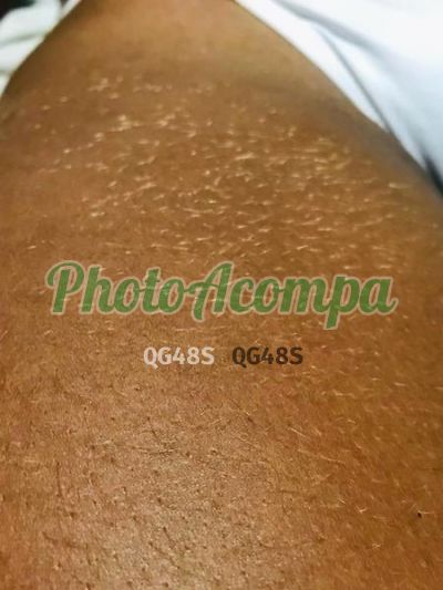 Foto 1 de Ayana, acompanhante em Recife - PE
