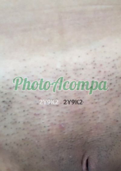 Foto 3 de Dafiny Lira, acompanhante em Ipojuca - PE